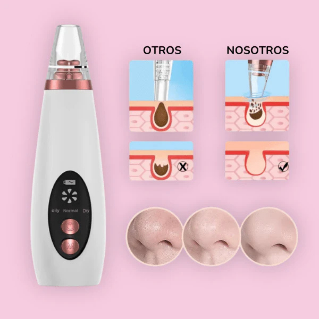 Removedor de Impurezas DermaVac Pro